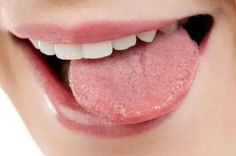 舌头发白是什么原因(口腔舌头发白是什么原因)