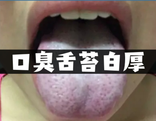 舌苔厚白是什么原因引起的怎么解决(儿童舌苔厚白的原因及解决方法)
