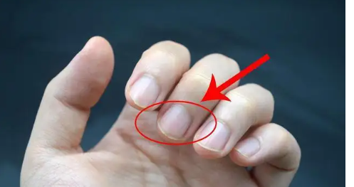 指甲有竖纹是身体的什么信号(指甲有竖纹)